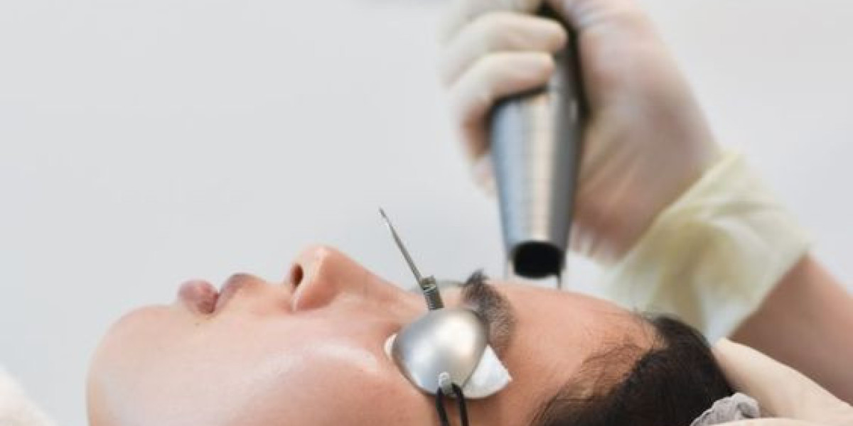 Where to Find the Best Laser Hair Removal Deals in Riyadh